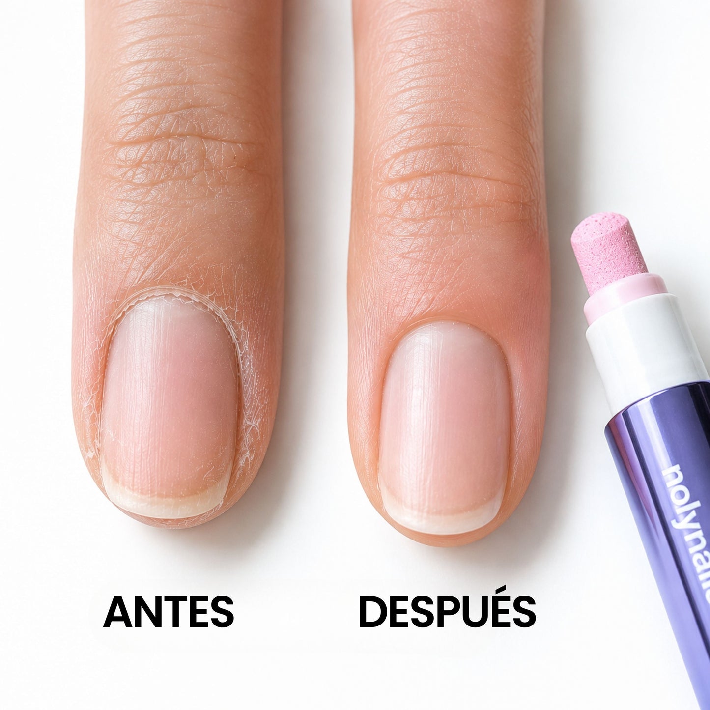 Caneta para Cutículas 3 em 1